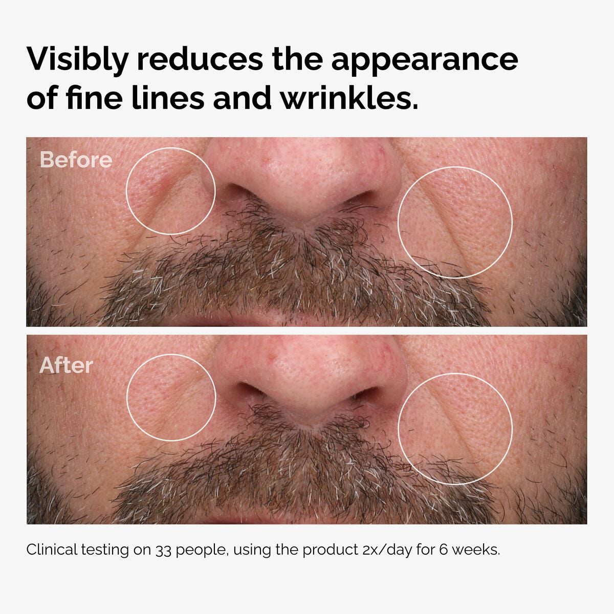 100-fermented-rose-hip-seed-oil-c8 100pct-fermented-rose-hip-before-after-wrinkles.jpg