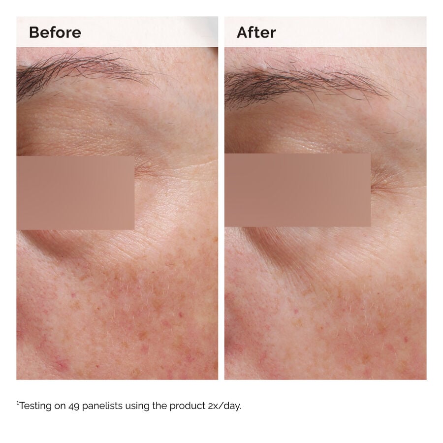 niacinamide-5-face-and-body-emulsion-h3 2024-08-23-ORD-Nia-5pct-Face-Body-B-A-Elasticity-Global-02-1x1.jpg