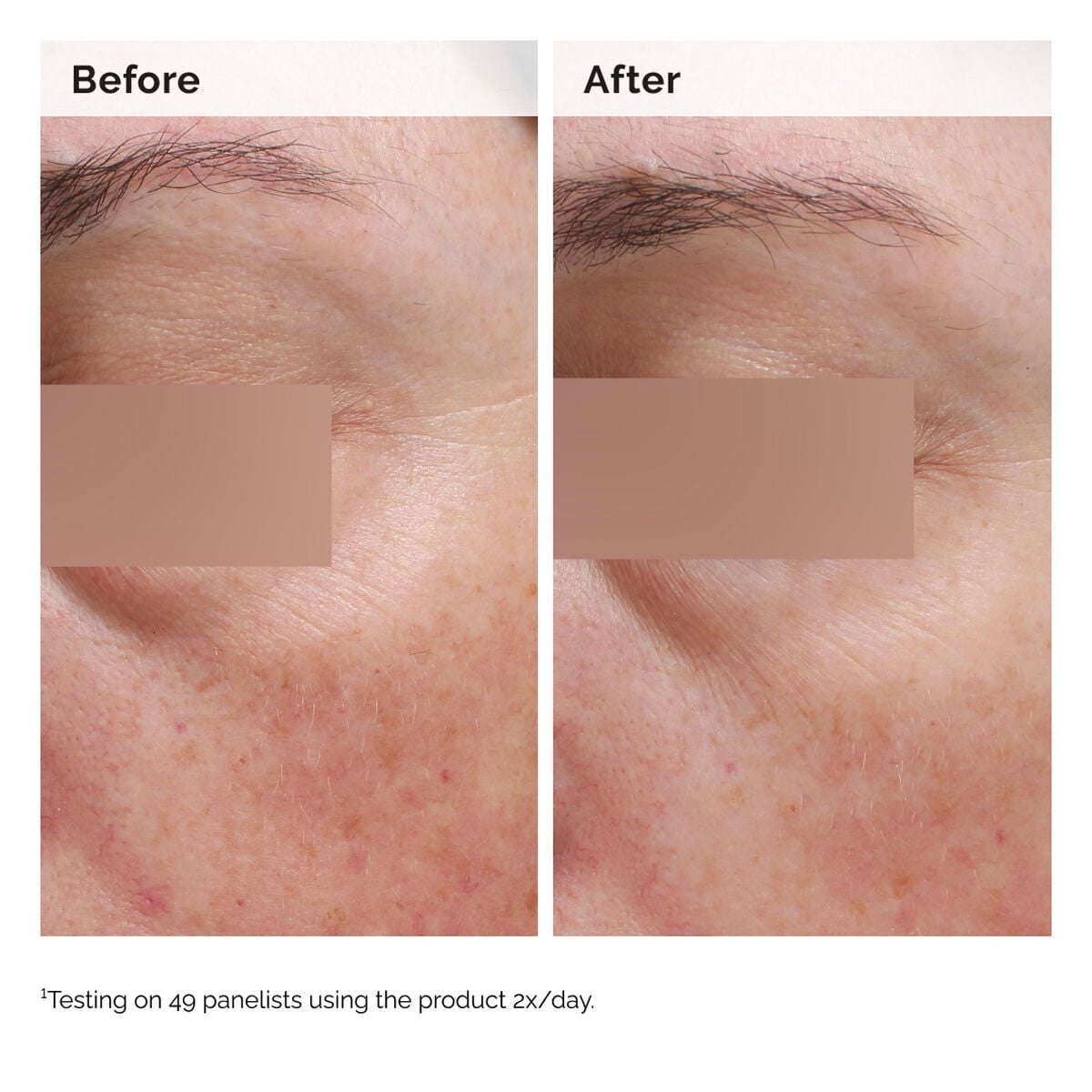 niacinamide-5-face-and-body-emulsion-h3 2024-08-23-ORD-Nia-5pct-Face-Body-B-A-Elasticity-Global-02-1x1.jpg