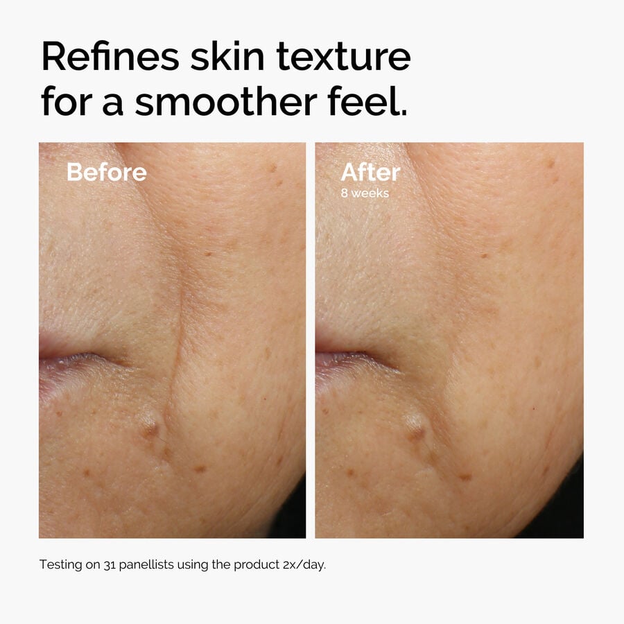caffeine-3-escin-1-face-serum-j4 ord-caffeine-3pct-escin-1pct-face-serum-before-after-texture.jpg