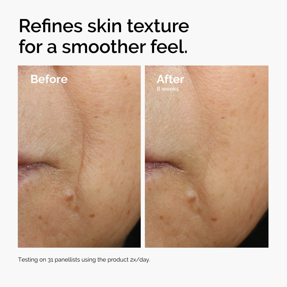 caffeine-3-escin-1-face-serum-j4 ord-caffeine-3pct-escin-1pct-face-serum-before-after-texture.jpg