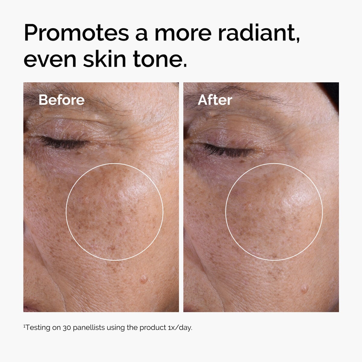 glycolic-acid-7-exfoliating-toner-k5 ord-glycolic-before-after-radiance.jpg
