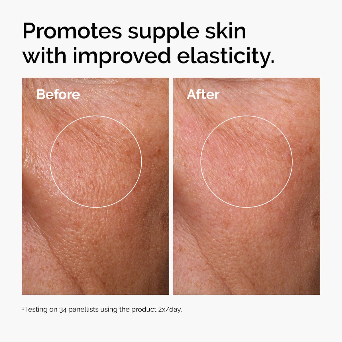 hyaluronic-acid-2-b5-with-ceramides-x2 ord-hyaluronic-acid-2pct-b5-hydrating-serum-before-after-elasticity.jpg