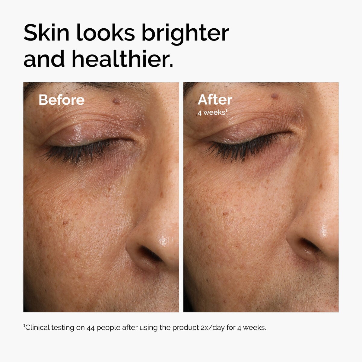multi-antioxidant-radiance-serum-m9 ord-mars-before-after-healthy.jpg