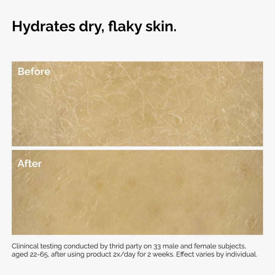 the-body-care-collection-f0 ord-natural-moisturizing-factors-inulin-body-before-after-graphic-02.jpg