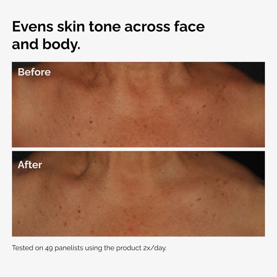 the-body-care-collection-f0 ord-niacinamide-face-body-serum-before-after-even-tone-graphic.jpg