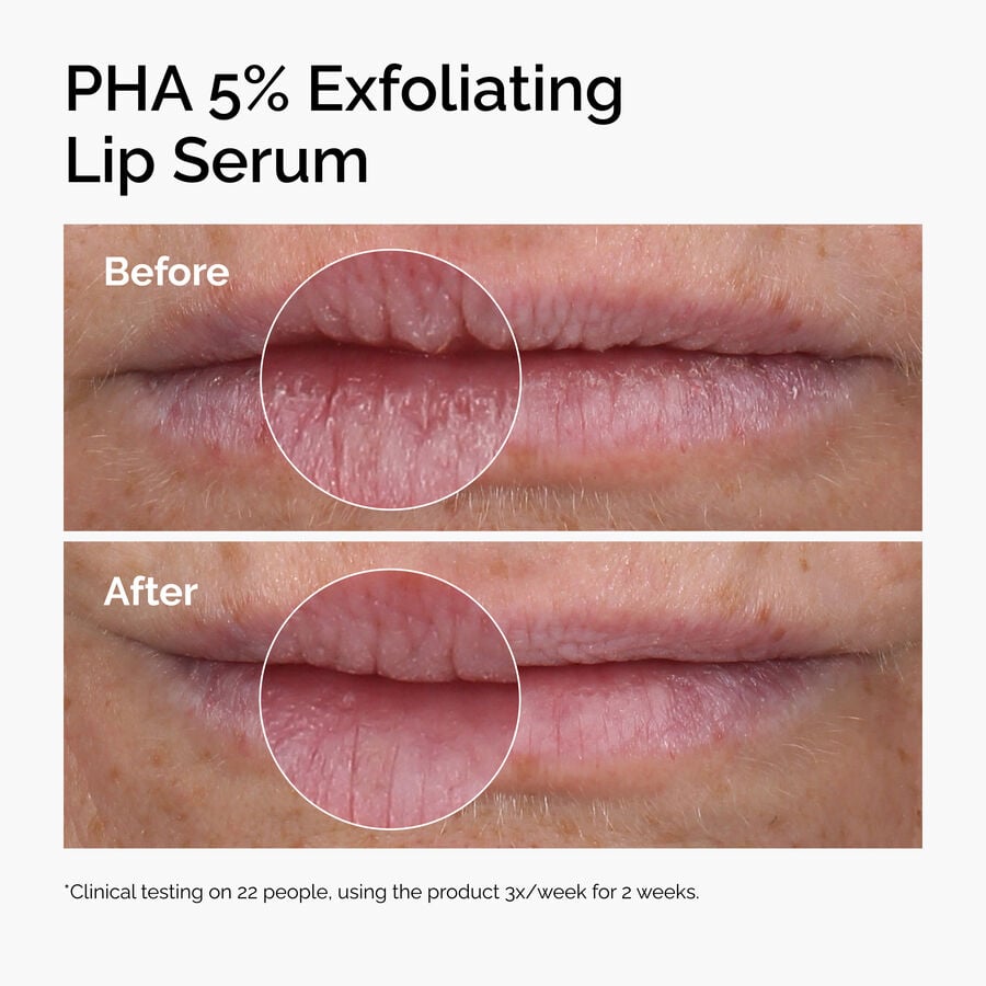 pha-5-exfoliating-lip-serum-m9 ord-pha-5pct-lip-exfoliating-serum-before-after.jpg
