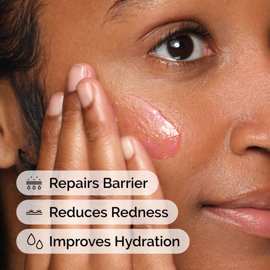 soothing-and-barrier-support-serum-y3 ord-soothing-barrier-support-serum-model-application-with-benefits.jpg