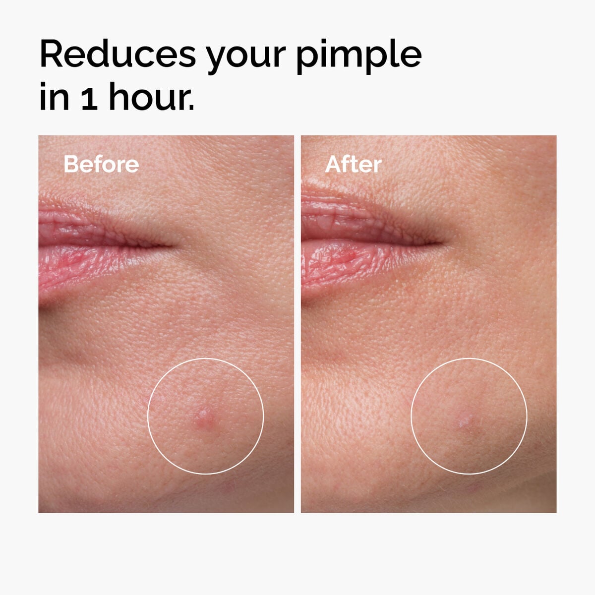 sulfur-10-powder-to-cream-concentrate-h0 ord-sulfur-10pct-powder-to-cream-concentrate-before-after-NA.jpg